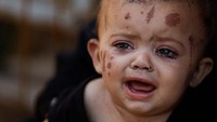 Seluruh anggota keluarganya tewas dalam serangan Israel di Gaza tepatnya di distrik selatan Khan Younis pada hari Selasa (13/8).  