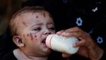 Kasihan! Bayi Ini Kehilangan Seluruh Keluarganya Akibat Serangan Israel