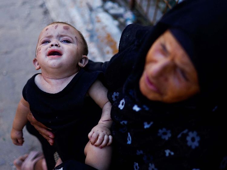 Kasihan! Bayi Ini Kehilangan Seluruh Keluarganya Akibat Serangan Israel