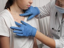 Swedia Catat Kasus Pertama Cacar Monyet Varian Baru yang Lebih Menular