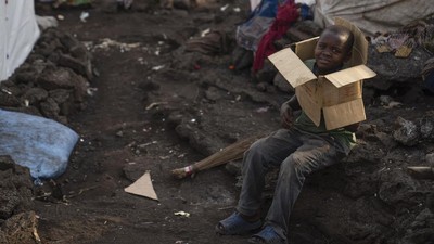 Wabah Cacar Monyet Mpox di Kongo Makin Meluas