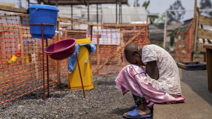 A health worker attends to a girl suffering from mpox, at a treatment centre in Munigi, eastern Congo, Friday, Aug. 16, 2024. (AP Photo/Moses Sawasawa)