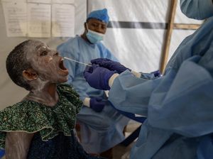 Cacar Monyet Mengganas di Kongo: Kasus Tembus 16 Ribu, 570 Meninggal