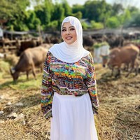 Setelah operasi bariatrik, Shindy juga sempat menjalani oplas hidung yang membuat penampilannya jadi makin berbeda. Operasi hidung atau rhinoplasty tersebut dijalaninya di sebuah klinik kecantikan di California, Amerika Serikat. Foto: Instagram/@rendyshindy_samuel