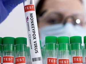 Apa Itu Virus Mpox yang Sudah Nyebar ke Jogja? Berikut Penjelasannya