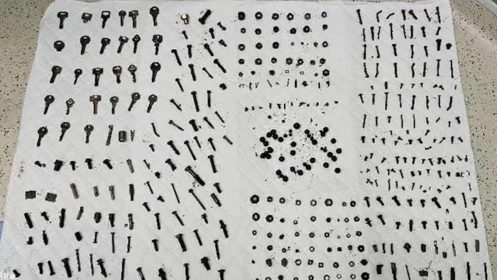 Ngilu! Penampakan Ratusan Benda Logam yang Dikeluarkan dari Tubuh Pria Iran