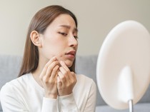 Ternyata Puasa Bisa Sembuhkan Jerawat! Berikut Penjelasannya