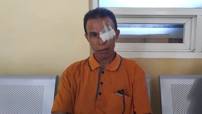 Sempat Takut Jalani Operasi Katarak, Guru di Ende Terbantu Program JKN