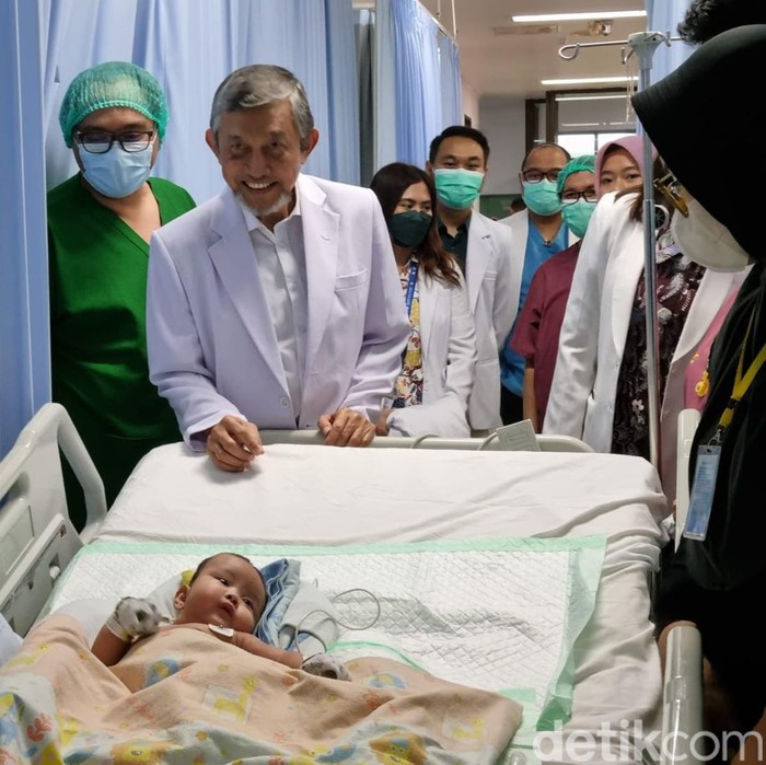 tim dokter kembar siam pantau kondisi arselo