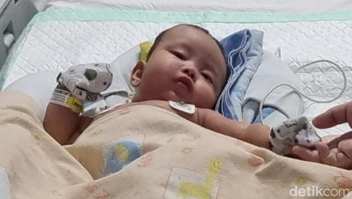 tim dokter kembar siam pantau kondisi arselo