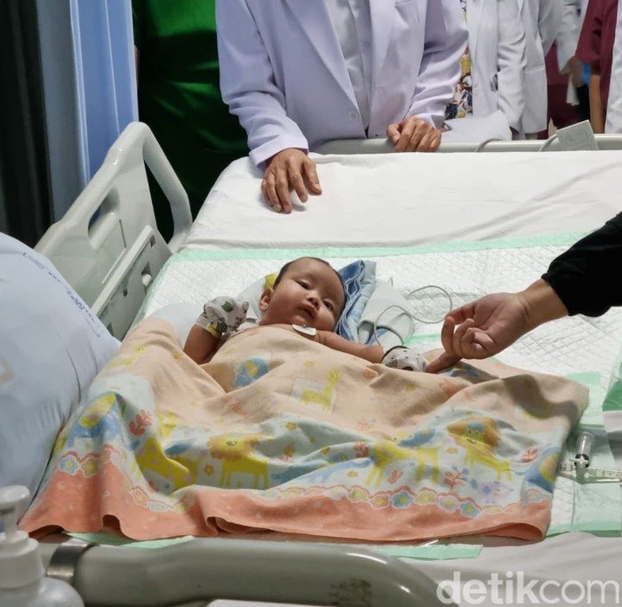 tim dokter kembar siam pantau kondisi arselo
