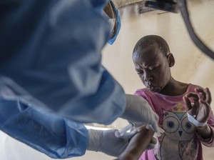 Ngeri, 62 Persen Kasus Mpox Ganas di DR Kongo Serang Usia Anak