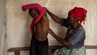 WHO pada hari Rabu (14/8) menyatakan lonjakan Mpox di Afrika sebagai darurat kesehatan masyarakat global atau Public Health Emergency of International Concern (PHEIC). (REUTERS/Arlette Bashizi)