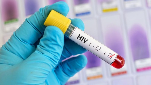 Ilustrasi Anak HIV