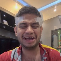 Uniknya, ternyata Fadil menggunakan bulu dadanya sendiri untuk ditanamkan ke rambutnya. Ia pun memamerkan baagian dadanya yang juga sama-sama diperban seperti bagian kepalanya. Foto: Instagram/@fadiljaidi