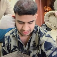 Bagian yang ikut menjalani prosedur tanam rambut itu juga tampak dibantu dibersihkan oleh kakak Fadil yang merupakan seorang dokter, Yislam Jaidi. Sambil membersihkan kepala Fadil, Yislam pun tertawa, ditambah saat dirinya mengingatkan Fadil jika adiknya itu harus datang ke acara wisuda Yislam dengan rambut rambut botak tersebut. Foto: Instagram/@fadiljaidi