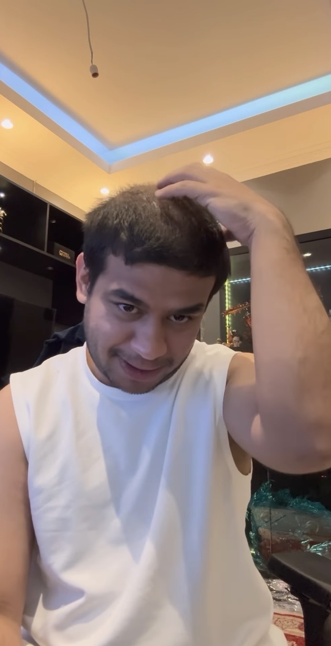 Melalui akun Instagram pribadinya YouTuber kocak Fadil Jaidi menceritakan dirinya yang mengalami kebotakan pada bagian tengah rambutnya. Kali ini dirinya mengaku tak bercanda dan memperlihatkan secara jelas bagian rambutnya yang sudah mulai botak. Foto: Instagram/@fadiljaidi