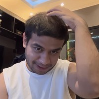 Melalui akun Instagram pribadinya YouTuber kocak Fadil Jaidi menceritakan dirinya yang mengalami kebotakan pada bagian tengah rambutnya. Kali ini dirinya mengaku tak bercanda dan memperlihatkan secara jelas bagian rambutnya yang sudah mulai botak. Foto: Instagram/@fadiljaidi