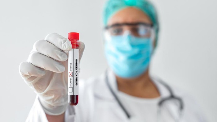 Monkeypox virus