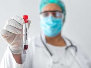 Makin Meluas, Ini Negara Baru yang Catat Mpox Varian Ganas