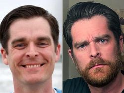 Perbedaan Drastis Pakai Brewok dan Tidak, Nggak Semua Cocok Cukuran