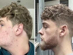 Perbedaan Drastis Pakai Brewok dan Tidak, Nggak Semua Cocok Cukuran