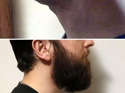 Perbedaan Drastis Pakai Brewok dan Tidak, Nggak Semua Cocok Cukuran