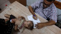 Seorang anak diperiksa dokter di tengah kekhawatiran akan penyebaran polio setelah kasus pertama dilaporkan oleh Kementerian Kesehatan, saat konflik antara Israel dan Hamas berlanjut, di Rumah Sakit Syuhada Al-Aqsa, di Deir Al-Balah di Jalur Gaza bagian tengah.  