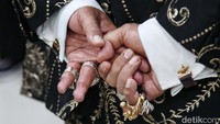 Hotman juga memakai cincin di empat jarinya.  