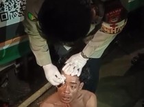 Polisi Jahit Luka Pendemo di Makassar, Ngaku Massa Bayaran