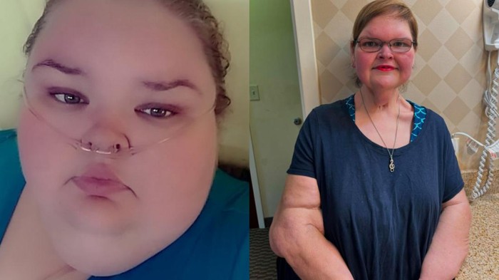 Before-After Diet Sukses Wanita di AS, BB Menyusut hingga 225 Kg