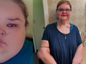 Before-After Diet Sukses Wanita di AS, BB Menyusut hingga 225 Kg
