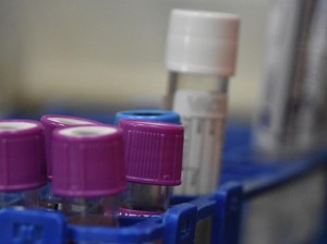 Bos WHO Bawa Kabar Baik soal Mpox! Bisa Jadi 6 Bulan Lagi Kelar