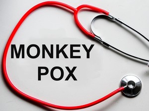 Teror Cacar Monyet Mengintai, Ini Cara Efektif Melindungi Diri