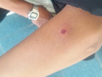 Pekerja Bawaslu Lampung Ditembak Orang Tak Dikenal