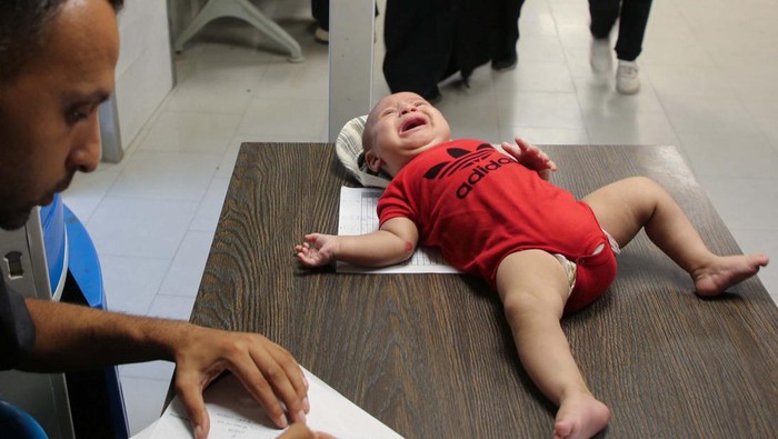 A Palestinian child is examined by a doctor at Nasser Hospital as United Nations officials are preparing to launch a polio vaccination campaign on Sunday that will rely on a series of limited pauses in fighting between Israeli forces and Hamas, in Khan Younis, in the southern Gaza Strip, August 30, 2024. REUTERS/Hatem Khaled