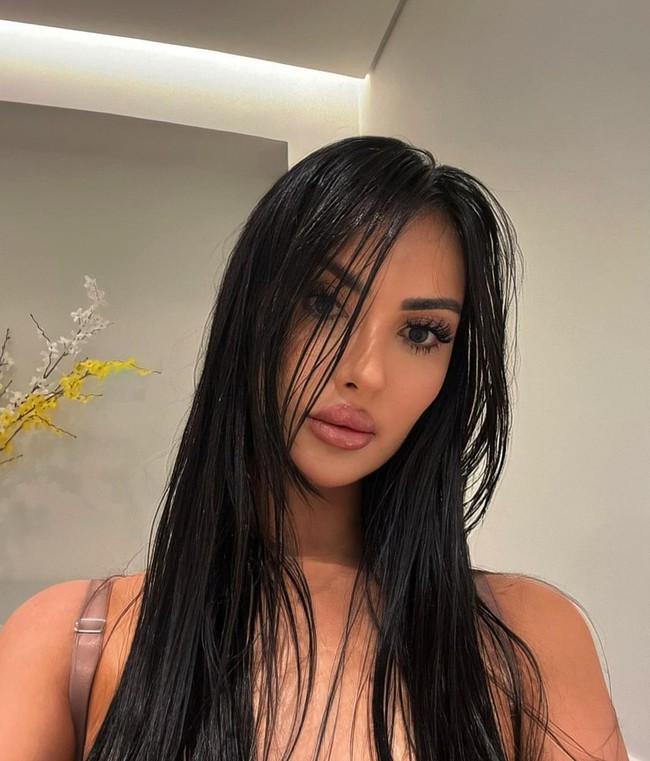 Pada usia 31 tahun, Jennifer telah menjalani lebih dari 30 prosedur bedah yang ia lakukan sejak remaja. Obsesi ini dimulai dari keinginan sederhana untuk memperbaiki penampilan, tetapi berubah menjadi kecanduan. Foto: dok. Instagram