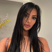 Pada usia 31 tahun, Jennifer telah menjalani lebih dari 30 prosedur bedah yang ia lakukan sejak remaja. Obsesi ini dimulai dari keinginan sederhana untuk memperbaiki penampilan, tetapi berubah menjadi kecanduan. Foto: dok. Instagram