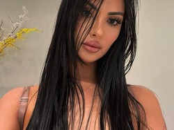 Foto Influencer 30 Kali Oplas Agar Mirip Kim Kardashian, Kini Menyesal