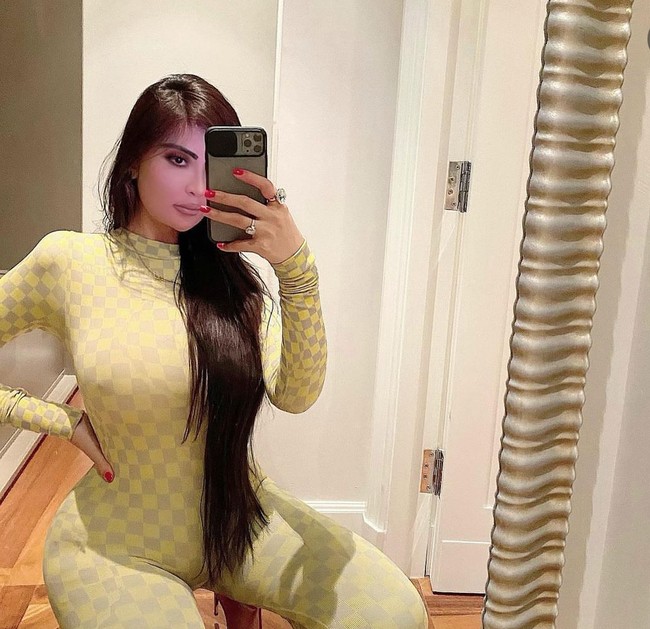 Jennifer kini berada dalam masa pemulihan psikologinya. Ia juga didiagnosis dengan gangguan dismorfia tubuh pada tahun 2022. Gangguan ini membuatnya terperangkap dalam siklus operasi yang tidak pernah berakhir, di mana ia selalu merasa tidak puas dengan hasil yang diperoleh.  Foto: dok. Instagram