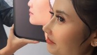 Ia membenarkan dirinya melakukan operasi plastik pada bagian hidung. Bahkan dalam unggahan terbarunya ia berbagi cerita masih merasa kaget dengan perubahan pada wajahnya. Foto: Instagram/riyukabunga
