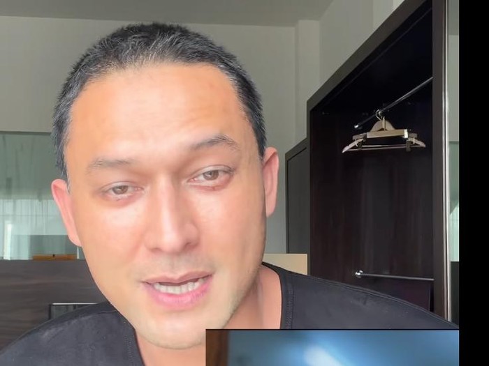 Indra L Bruggman usai menjalankan operasi plastik.