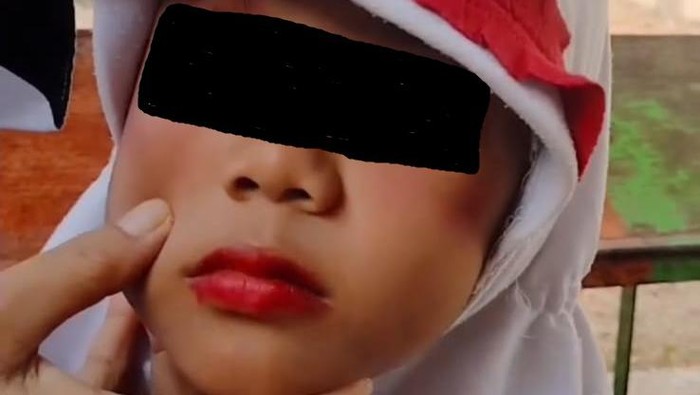 Anak di Ogan Ilir dianiaya ibu kandung lalu didandani untuk tutupi luka.