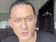 Indra Bruggman Oplas demi Kembalikan Bentuk Mata karena Hipertiroid