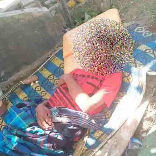 Pengamen asal Lombok meninggal seusai diduga ditolak PKM Woha, Kabupaten Bima, NTB. (Istimewa)