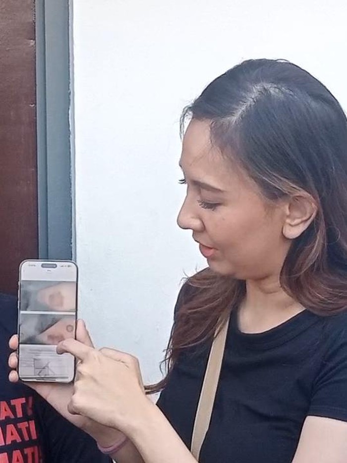 Sahabat Tamara Tyasmara Sahabat memperlihatkan foto bukti luka Tamara Tyasmara.