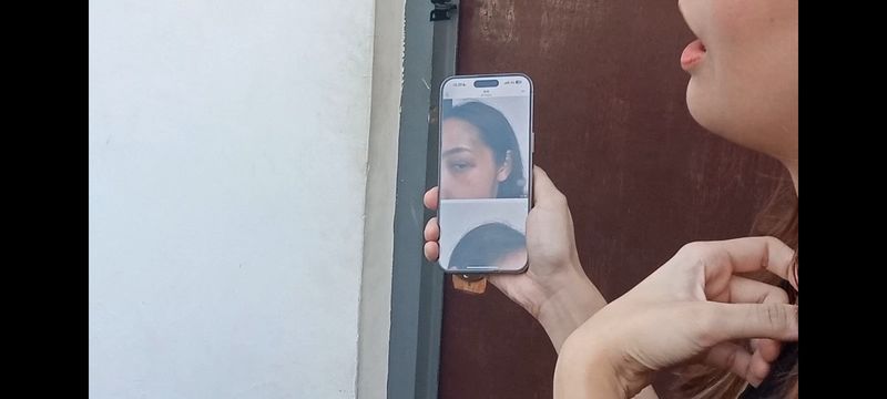 Sahabat memperlihatkan foto bukti luka Tamara Tyasmara.