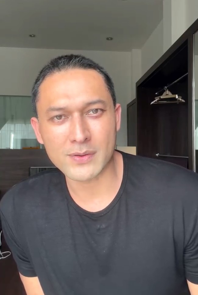 Begini penampilan terbaru Indra Bruggman usai jalani operasi plastik. Diakui Indra saat ini bagian matanya masih bengkak dan belum pulih maksimal, mengingat dirinya juga baru menjalani operasi plastik 1 minggu yang lalu. Foto: Instagram/@indrabruggman