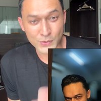 Indra menjelaskan bahwa untuk bagian wajahnya sendiri tak ada yang berubah. Hidung, kulit, bibir, dan semuanya masih sama seperti sebelumnya. Foto: Instagram/@indrabruggman