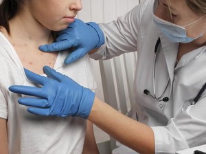 5 Makanan Penguat Imunitas, Cocok untuk Cegah Monkeypox